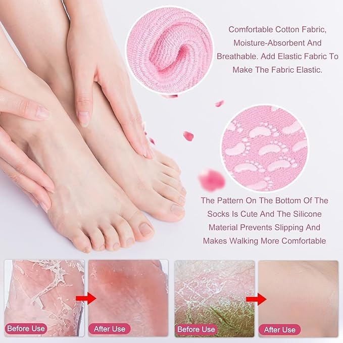 Silicone Spa Heel Repair Gel Socks - Image 4